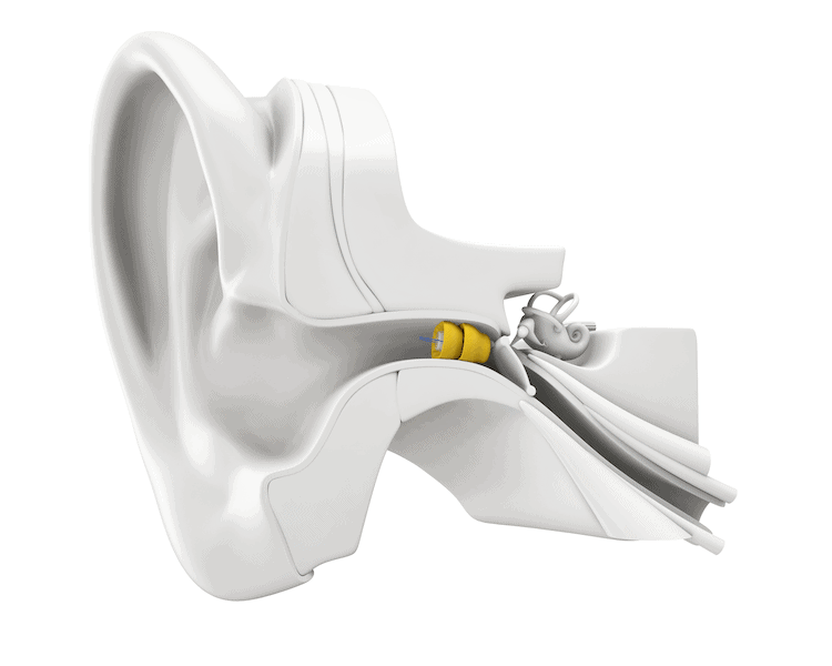 lyric hearing aids