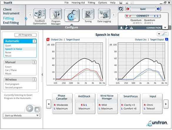 Unitron Hearing Aids