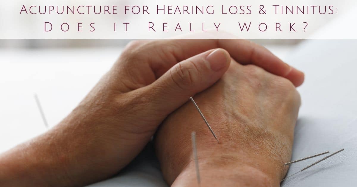 Can Acupuncture Work For Tinnitus